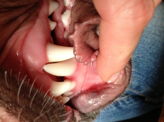 Einige Wochen später sind die  Zähne richtig platziert und das ohne künstliche Regulierung. 